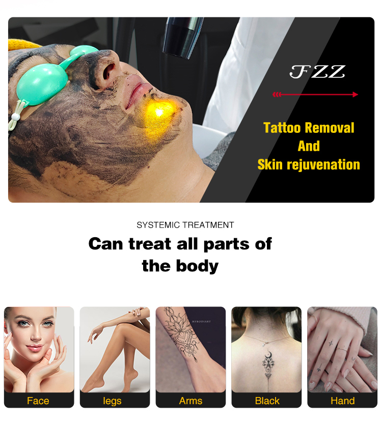 ND Yag Laser - Afbeelding 11